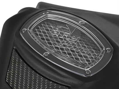aFe Momentum GT Pro Dry S Air Intake Systems 51-72104